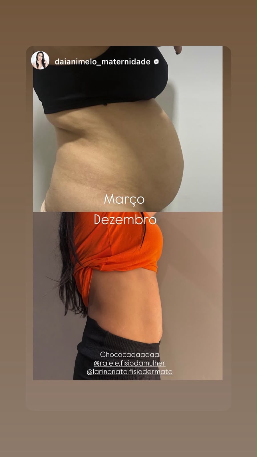 Di&aacute;stase Abdominal 1