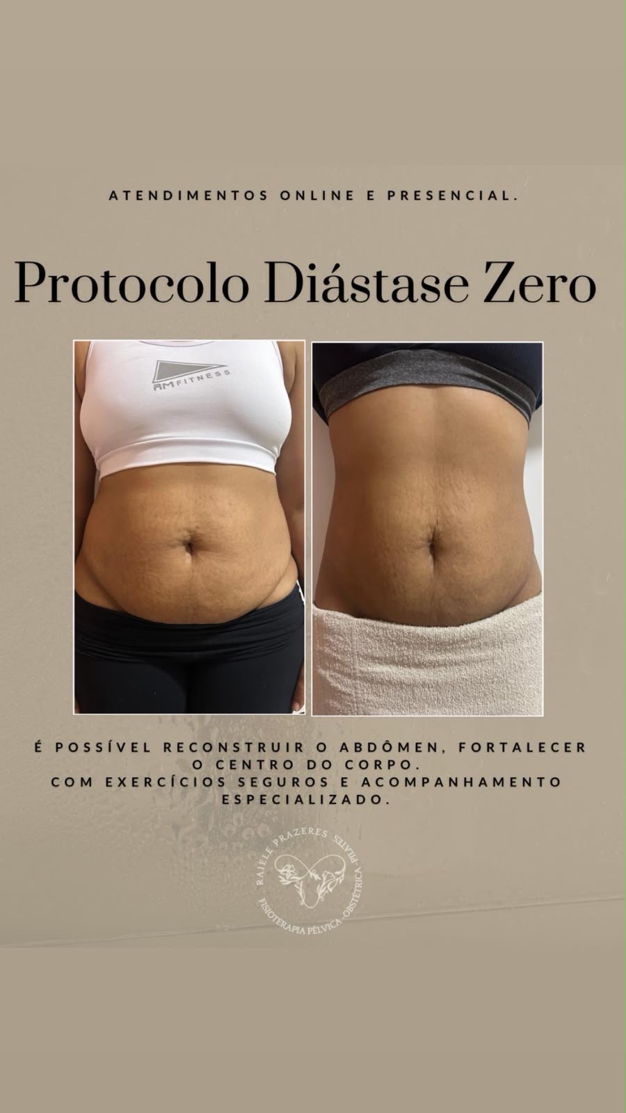 Di&aacute;stase Abdominal 2