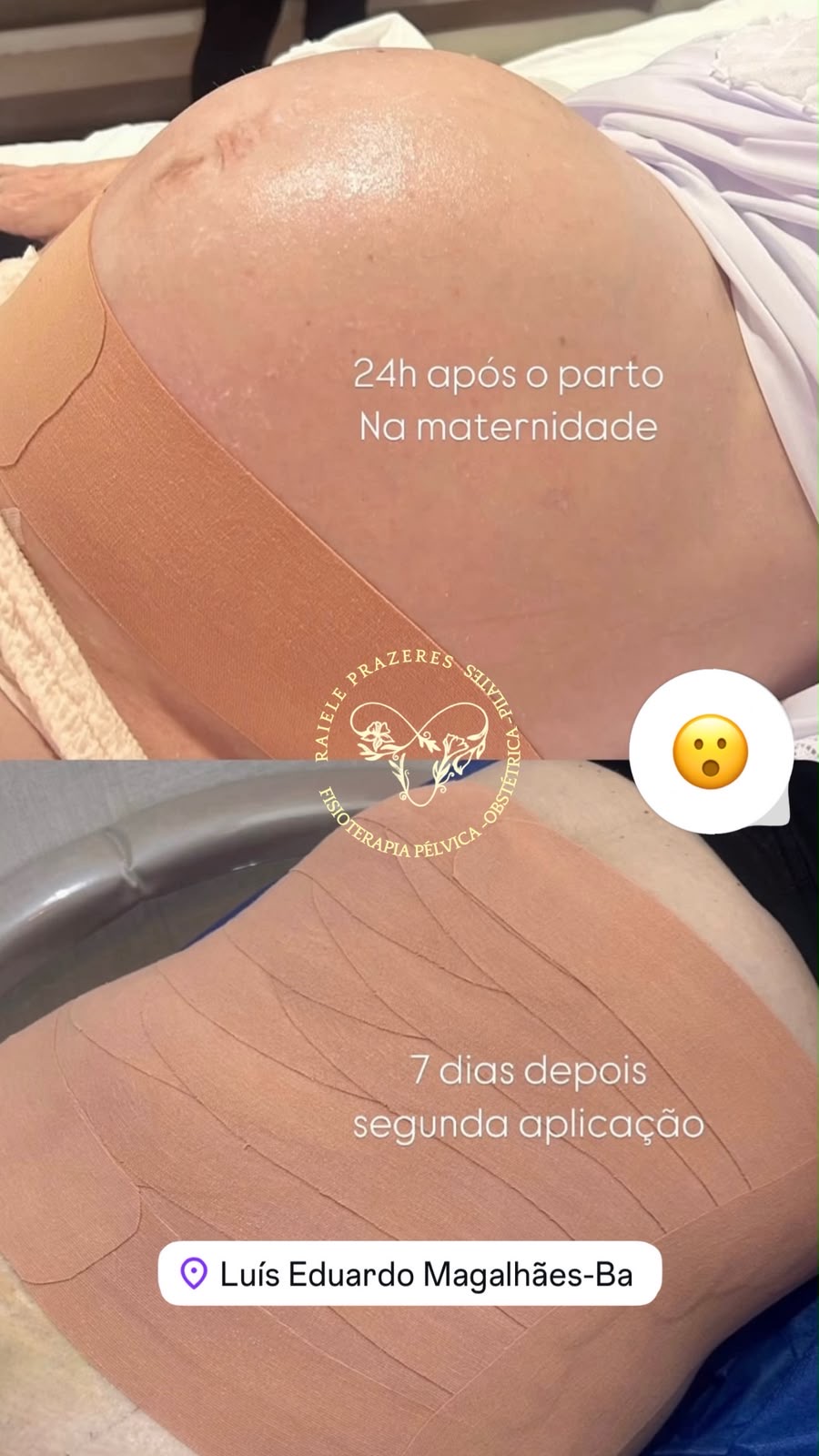 P&oacute;s Parto 2
